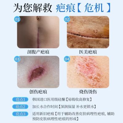 医用硅酮凝胶原蛋白剖腹产祛疤膏