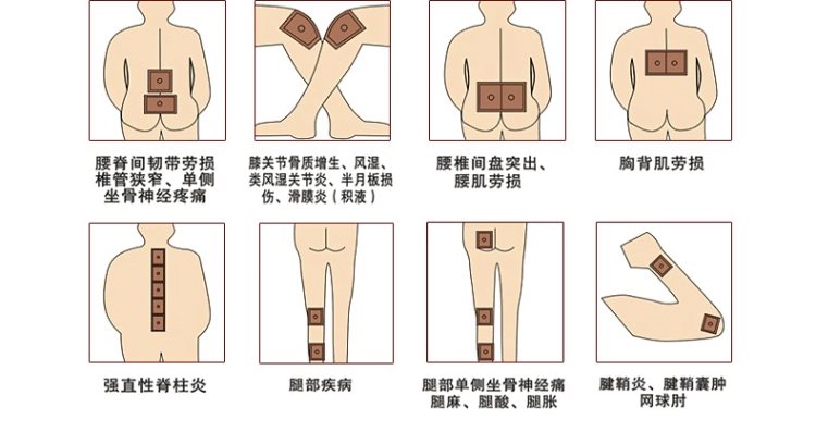 健康礼品 颈椎病肩周炎贴膏蜂毒风湿类关节痛腰疼腰椎贴腰间盘突出专用膏贴